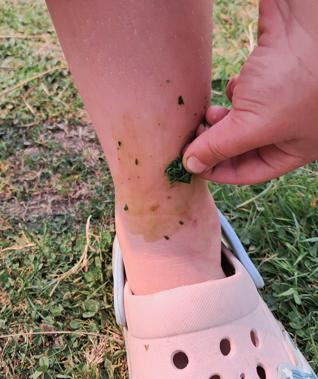 Nature’s Gentle Antidote: Ribwort Plantain for Children’s Scrapes and Stings